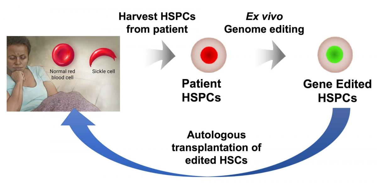 New Genetic Weapons Challenge Sickle Cell Disease Ken Kennedy