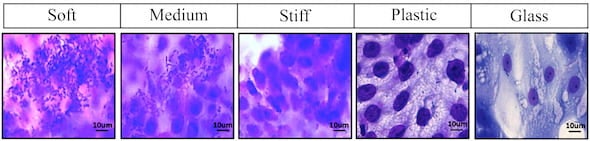 pathogen 2