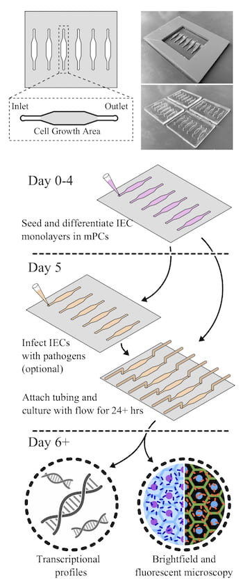 intestine