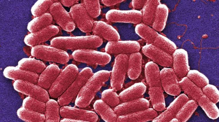 Rice University scientists have built a model to predict how long, on average, it takes to eradicate bacterial infections like those caused by shigella, above, with antibiotics. Courtesy of the U.S. Centers for Disease Control and Prevention